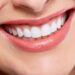 The Role of Cosmetic Dentistry in Smiling Makeover