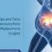 Recovery Tips Post Orthopedic Surgery