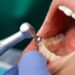 From Routine to Radiant: The Importance of Regular Dental Cleanings